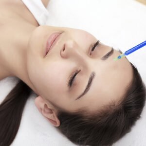 Mesoterapia Facial